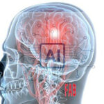 FAB IA BRAIN